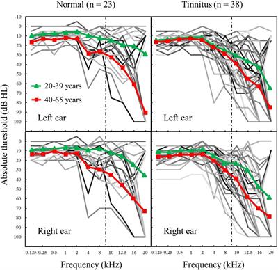 Relationships Among Temporal Fine Structure Sensitivity, Transient Storage Capacity, and Ultra-High Frequency Hearing Thresholds in Tinnitus Patients and Normal Adults of Different Ages